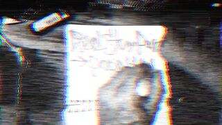 Realstumpers practicing writing with right prosthetic hand