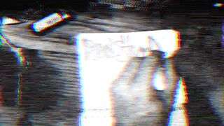 Realstumpers practicing writing with right prosthetic hand