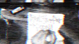 Realstumpers practicing writing with right prosthetic hand