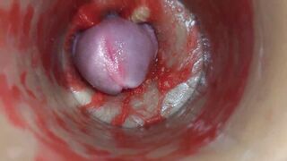 Camera Inside Unfathomable Twat Captures Very Biggest Spunk fountain of Semen ASMR