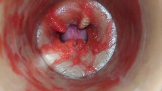 Camera Inside Unfathomable Twat Captures Very Biggest Spunk fountain of Semen ASMR