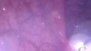 WEB CAMERA INSIDE BOOTY: The Balls disappeared unfathomable inside my aperture ⚽⛓ - Preview