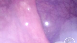 WEB CAMERA INSIDE BOOTY: The Balls disappeared unfathomable inside my aperture ⚽⛓ - Preview