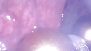 WEB CAMERA INSIDE BOOTY: The Balls disappeared unfathomable inside my aperture ⚽⛓ - Preview