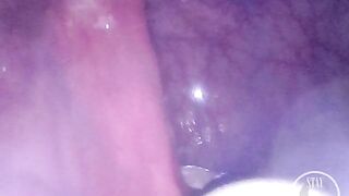 WEB CAMERA INSIDE BOOTY: The Balls disappeared unfathomable inside my aperture ⚽⛓ - Preview