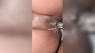 Step brother stepped into my vagina and did this