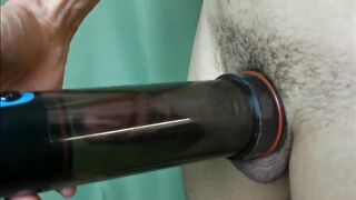 vacuum pump increases penis