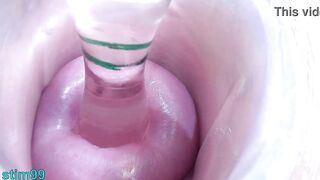 Lesbian babes cervix play penetration, fingering and piddle directly into the bladder of the other woman by peehole