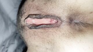 Anal-vaginal multiformity