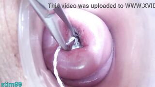 Lesbos pissing into the cervix of the other one directly since her pee gap