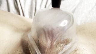 Vagina Pumping My Large Love button With My Recent Vagina Pump