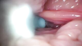 Sperm in Cervix Wide Stretching Snatch Endoscope!