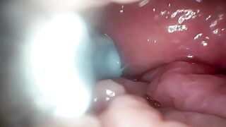 Sperm in Cervix Wide Stretching Snatch Endoscope!