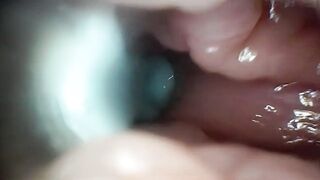 Sperm in Cervix Wide Stretching Snatch Endoscope!