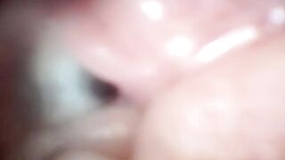 Sperm in Cervix Wide Stretching Snatch Endoscope!