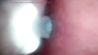 Sperm in Cervix Wide Stretching Snatch Endoscope!