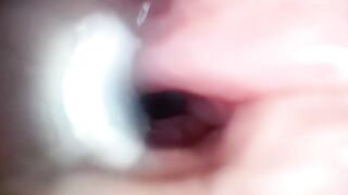 Sperm in Cervix Wide Stretching Snatch Endoscope!