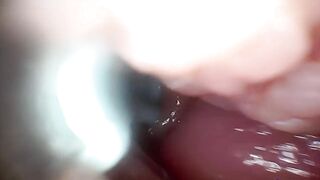Sperm in Cervix Wide Stretching Snatch Endoscope!