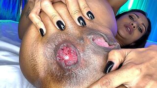 flexi slender mother i'd like to fuck prolapse her asshole for coarse banging