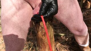 Outdoor neon catheter insertion