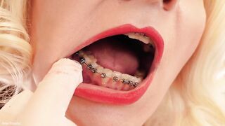 Medical Gloves, hawt braces and hawt cunt - fetish clip of hawt mother I'd like to fuck
