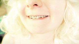 Braces Fetish: mukbang episode