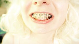 Braces Fetish: mukbang episode