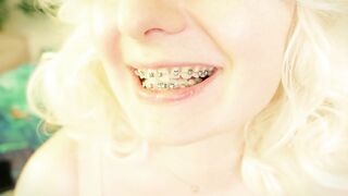 Braces Fetish: mukbang episode