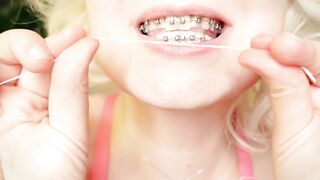 My 2nd day in braces: cleaning by dental floss