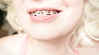 My 2nd day in braces: cleaning by dental floss