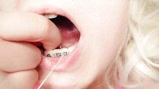 My 2nd day in braces: cleaning by dental floss