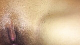 Me duele por el culito