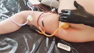 Massive stomach inflation using my enema machine and inflatable bardex nozzle