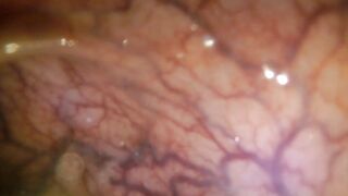 POV: Gulping u into the tip of my transverse