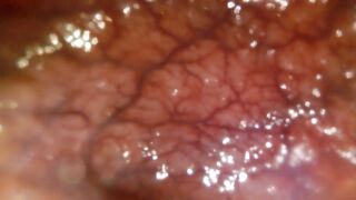 POV: Gulping u into the tip of my transverse