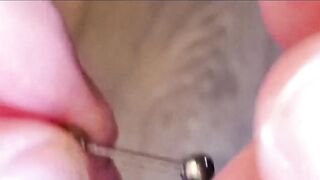 Pretty Frenum Knob "Jewelry Changes"