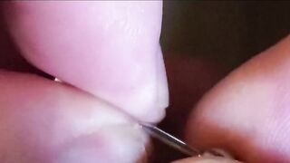 Pretty Frenum Knob "Jewelry Changes"