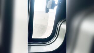 I woke up with swollen nipps and look what happened