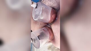 Extraordinary Double Pump Disclose 2026