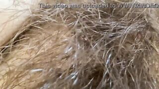 Bizarre Close Up Large Clitoris Cunt