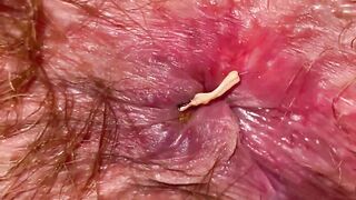 Bizarre Close Up Large Clitoris Cunt