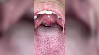 Mira que tanto metal tengo en mi boca ????