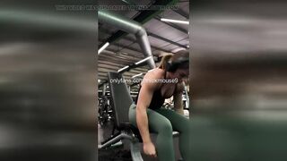 18yo Fisting Accident: Arm Elbow-Unfathomable in Cunt on Live Stream