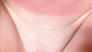 Little Step Sister's Sun Burn Accident - Family Therapy - Alex Adams