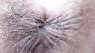 Extraordinary close up on my winking arsehole