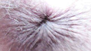 Extraordinary close up on my winking arsehole