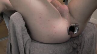 Dilatation extraordinary avec speculum, gode à travers spéculum