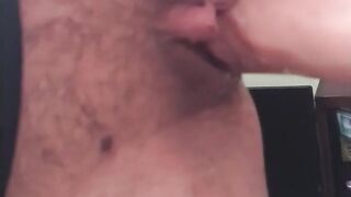 Cream oozing on jock
