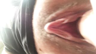 Cream oozing on jock