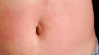I show my red abdomen from the punishment I received from the red stomach game, my belly inflamed